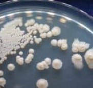 Streptomyces cacaoi
